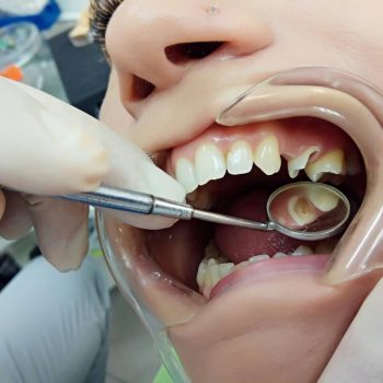 stomatologia-v-odesse-e-max